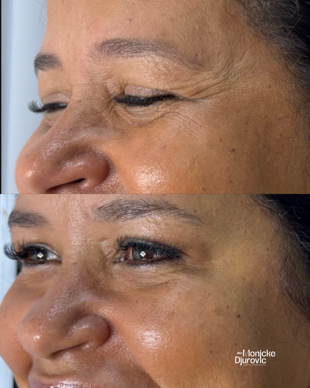 Registro visual autorizado de antes e depois — comparação 2.