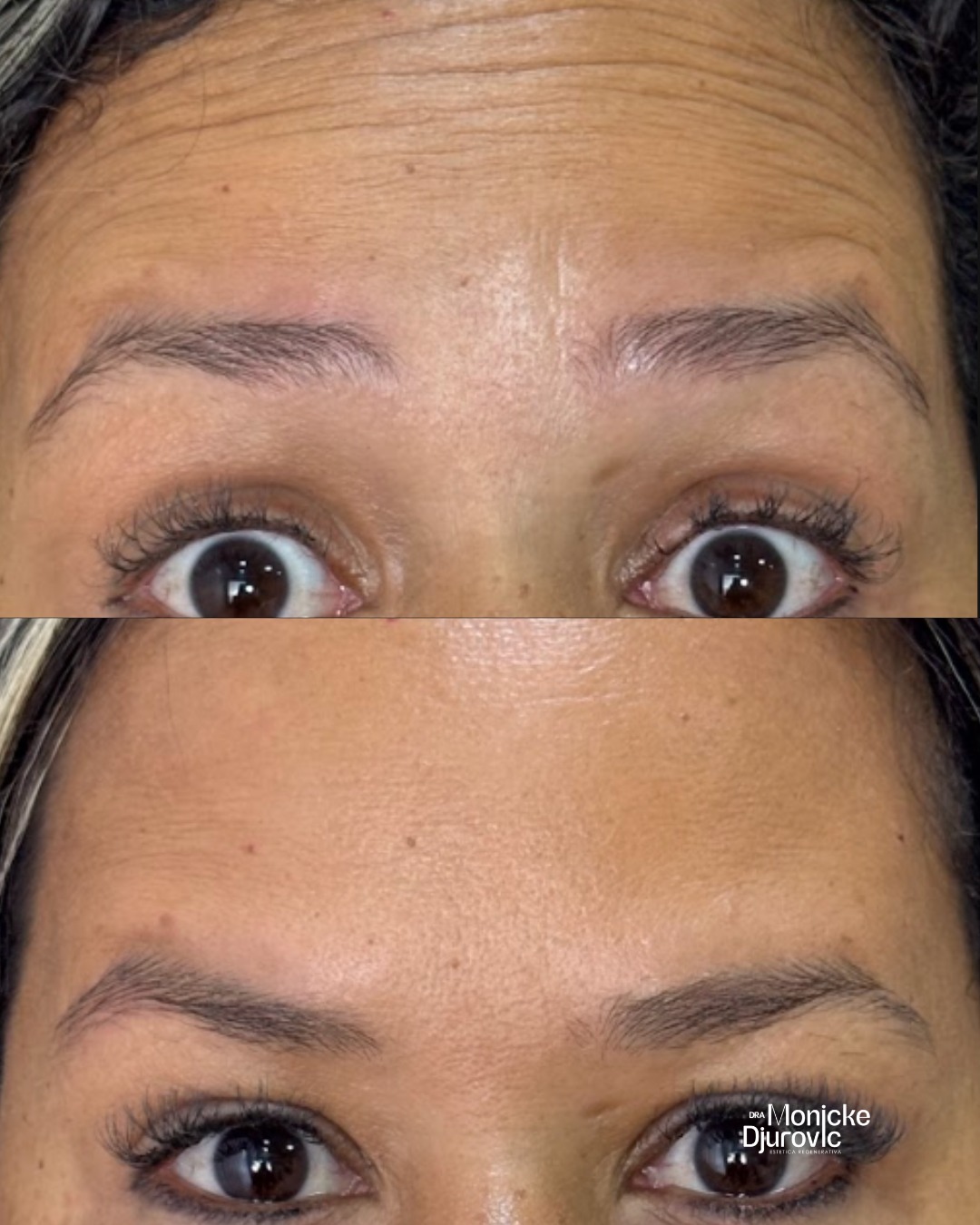 Registro visual autorizado de antes e depois — comparação 1.