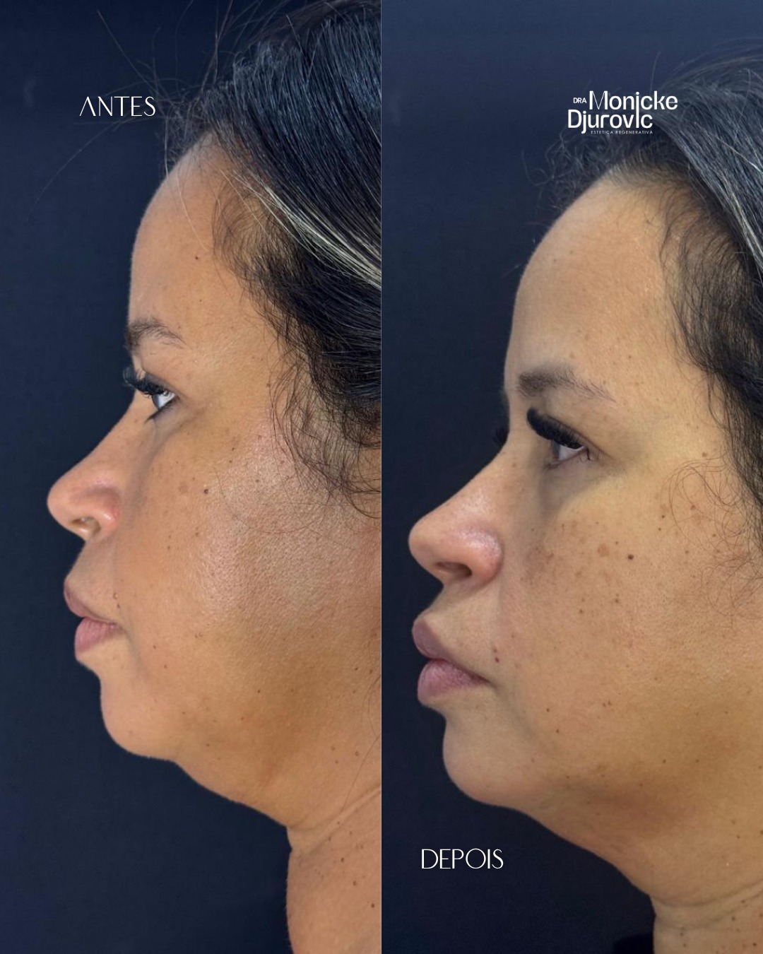 Registro visual autorizado de antes e depois — comparação 3.