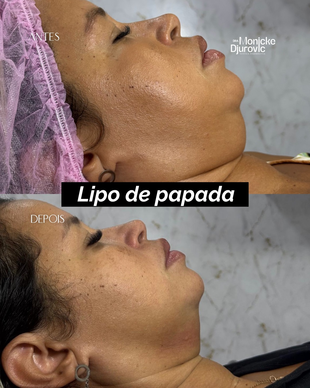 Registro visual autorizado de antes e depois — comparação 4.